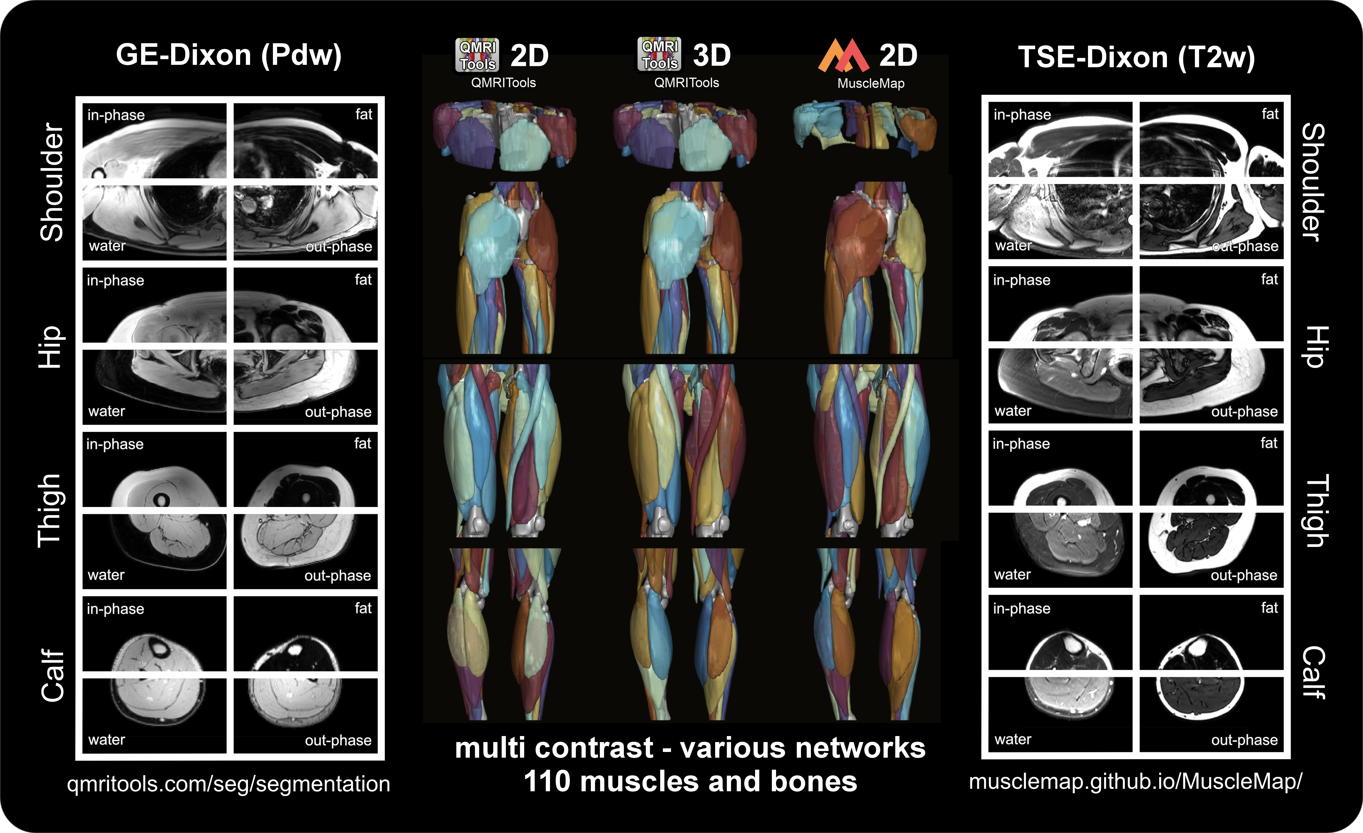 Automated muscle segmentation